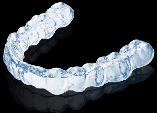 Clear Paths to Confident Smiles: Why lulusmiles Chooses Simple Orthodontic Solutions